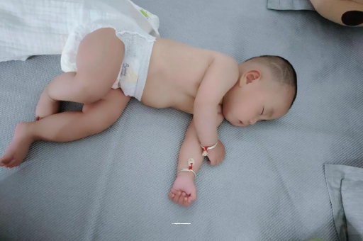 姜堰六个月宝宝眼睛散光